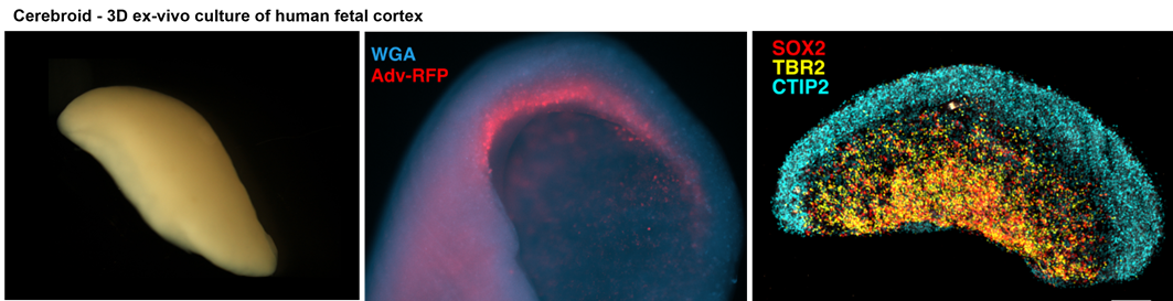 Human fetal brain cerebroids shown at different scales and labelled for cortical markers