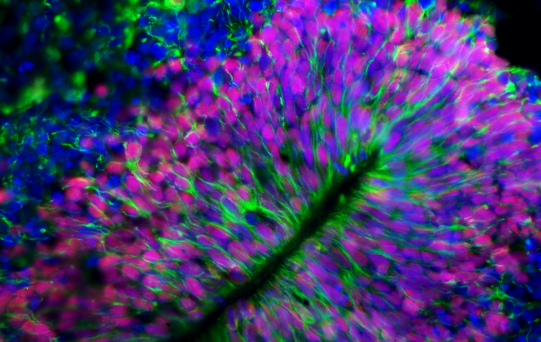 Human cortical organoid labelled for nestin and SOX2
